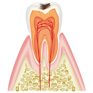 C1
